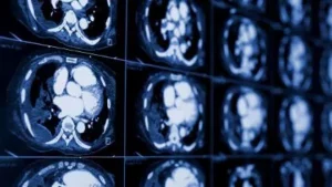 image of brain scan
