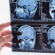 Traumatic Brain Injury Icon