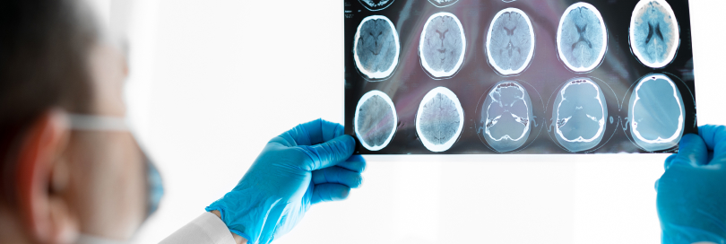 traumatic brain injury